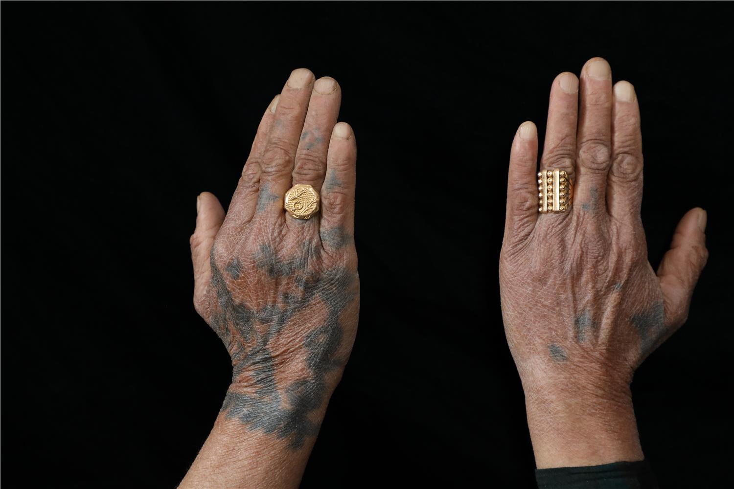 Where Skin Becomes Story: Photographing the Living Traditions of Southeastern Turkey